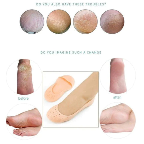 Buy Dropp™ Anti Crack Full Length Silicone Foot Protector
