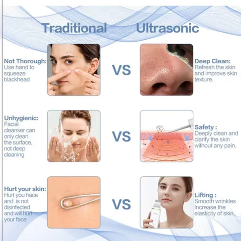 Buy Dropp™ Ultrasonic Facial Skin Scrubber