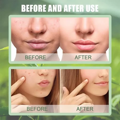 Buydropp® The Magic Green Stick Mask