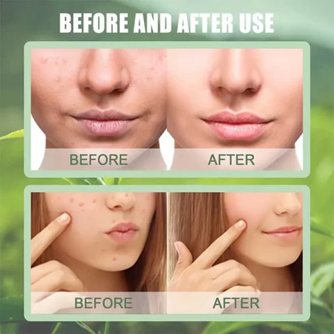 Buy Dropp™  The Magic Green Stick Mask