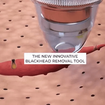 Buy Dropp™ Blackheads Remover Vacuum